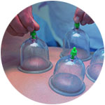 Massage cupping therapy